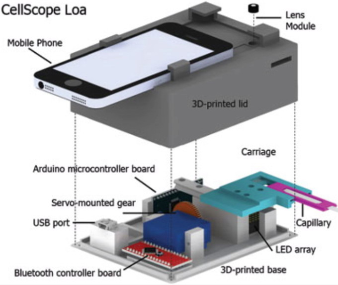 при помощи смартфона и прибора CellScope Loa определит уровень заражения глазным червем.