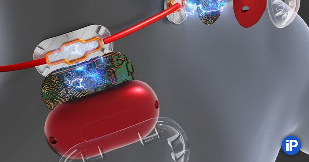 fbimg.php?img=https%3A%2F%2Fwww.iphones.