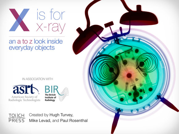 X is for X-Ray. Под лучами рентгена