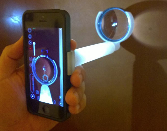 Стэнфордский университет создал профессиональный офтальмологический аксессуар для iPhone