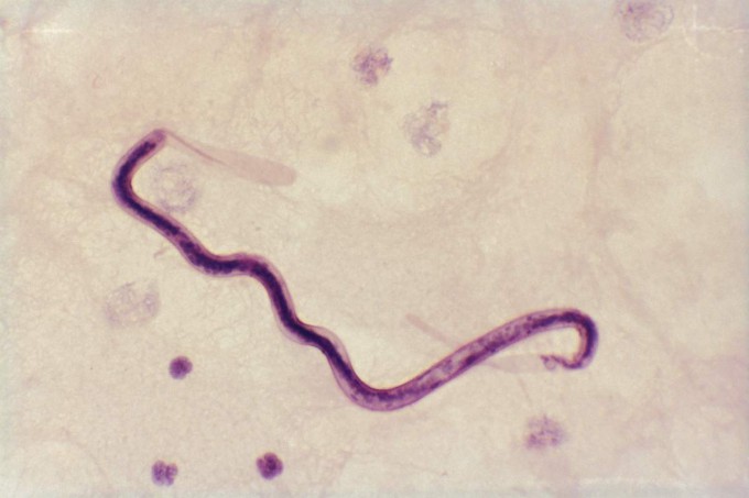 loa-loa-parasite-worm