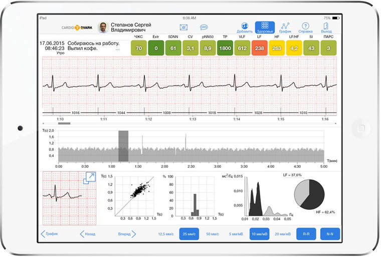 ipad_prosmotr_EKG_lenta