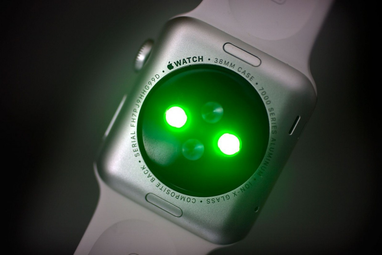 Apple могла внедрить сканеры здоровья в ремешки Apple Watch