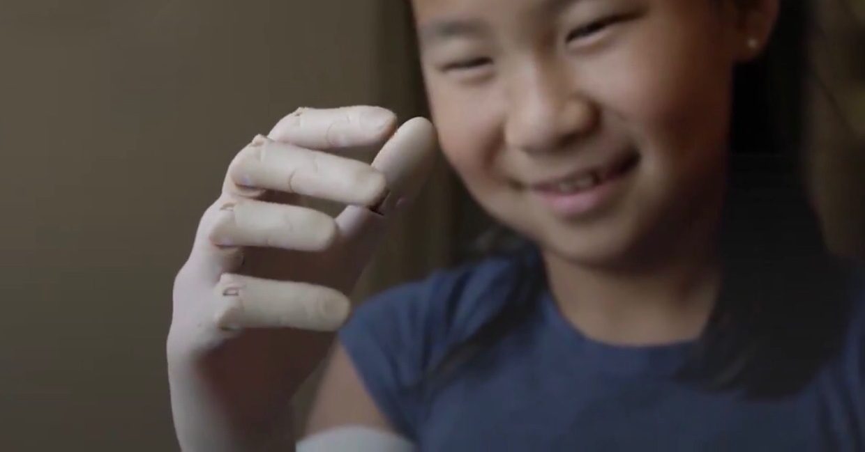 Это самый крутой ручной протез, напечатанный на 3D-принтере