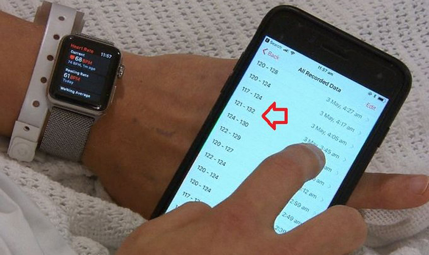 Apple Watch спасли жизнь 24-летнего парня