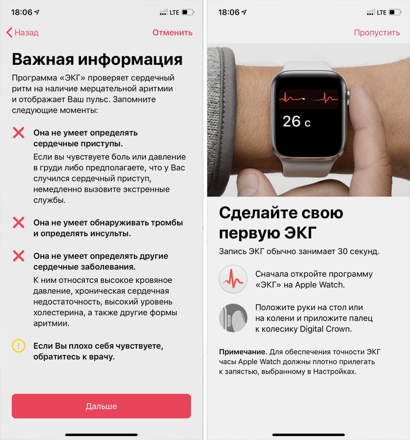 Смарт часы показывают неправильно. Apple watch 7 ЭКГ. Умные часы с функцией ЭКГ И измерения давления. ЭКГ на Эппл вотч 6. Кардиограмма на Эппл вотч.