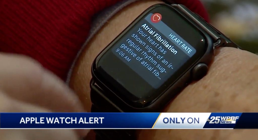 Apple Watch предупредили владельца о мерцательной аритмии, о которой он даже не догадывался
