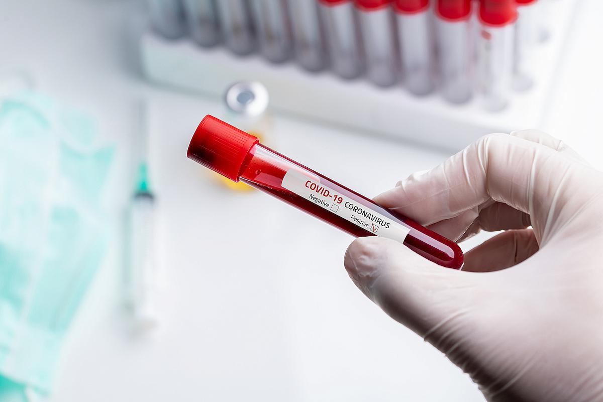 Две частные лаборатории начали проводить тесты на коронавирус в России с 26 марта
