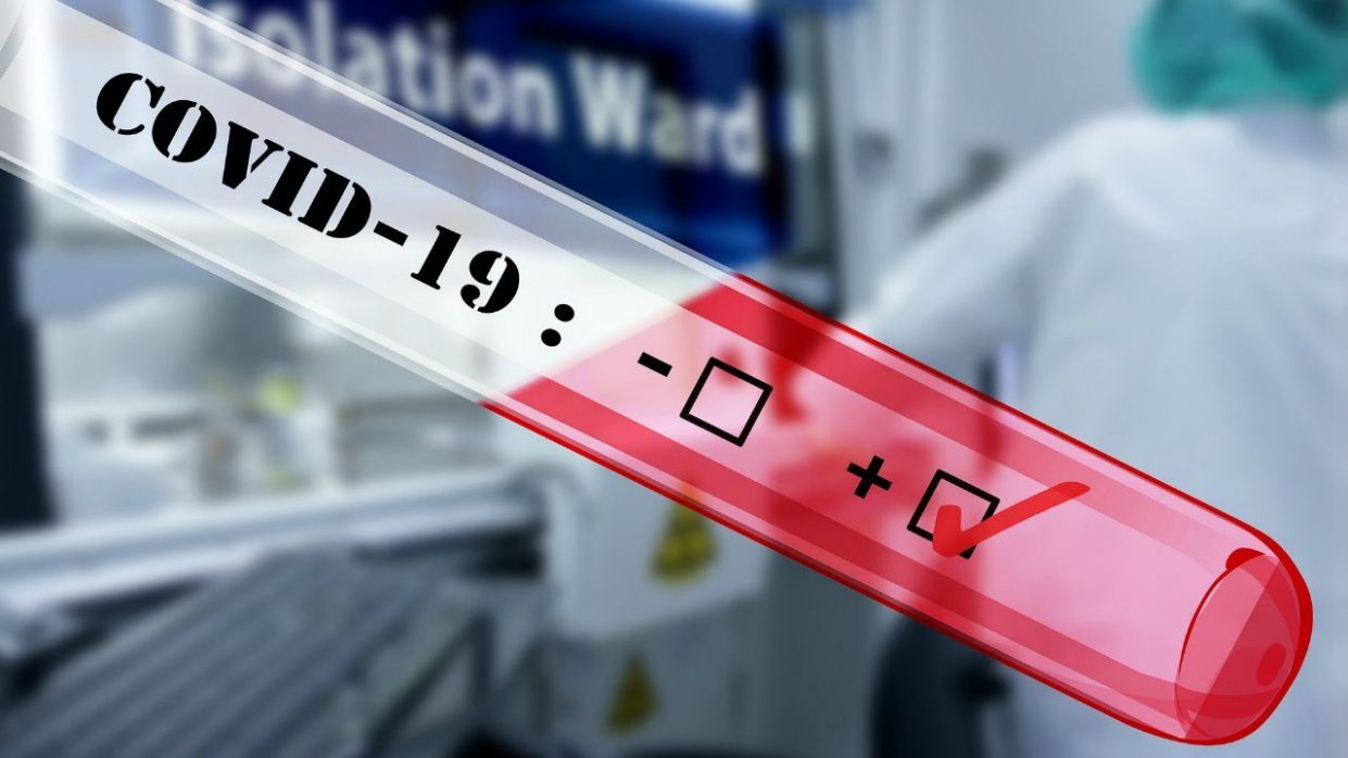 Яндекс сделал бесплатное тестирование на коронавирус в Москве и Подмосковье