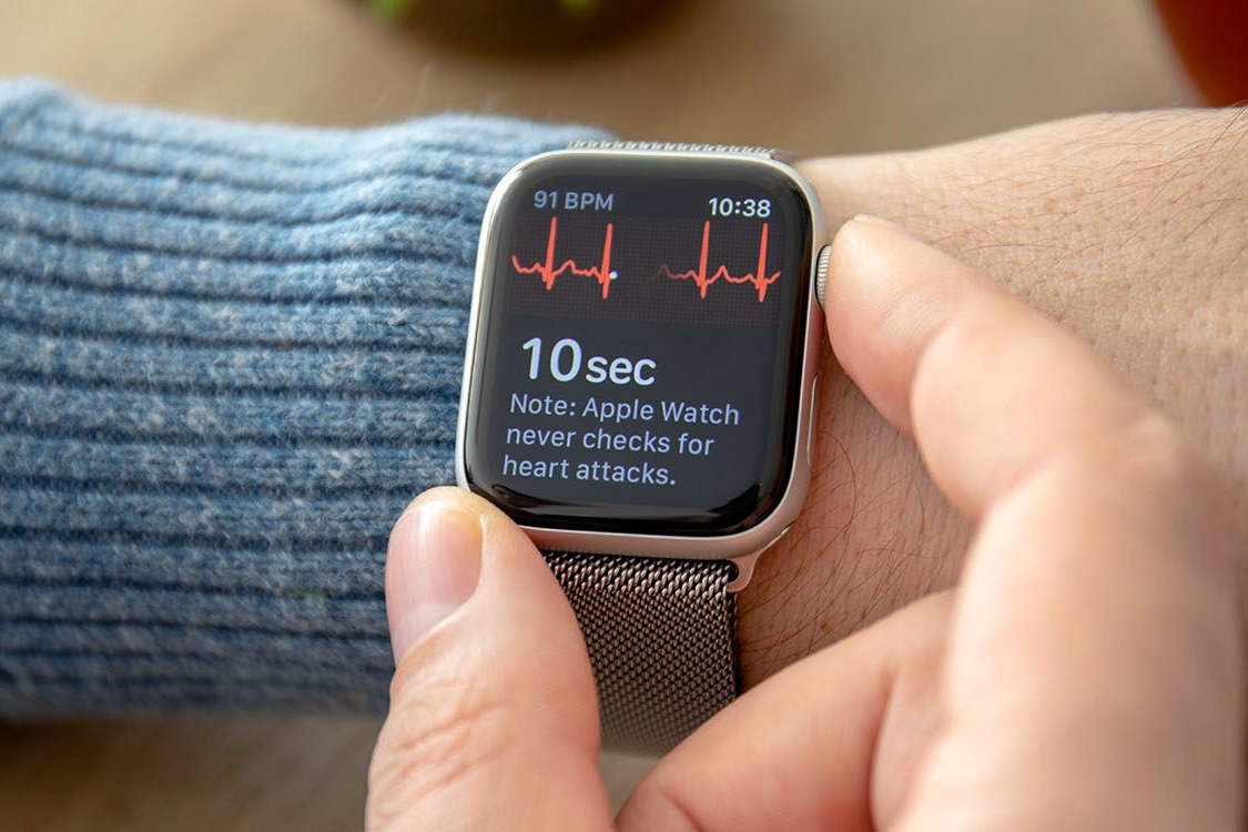 Apple Watch определили у женщины ишемию сердечного миокарда, которую не нашли врачи и даже ЭКГ
