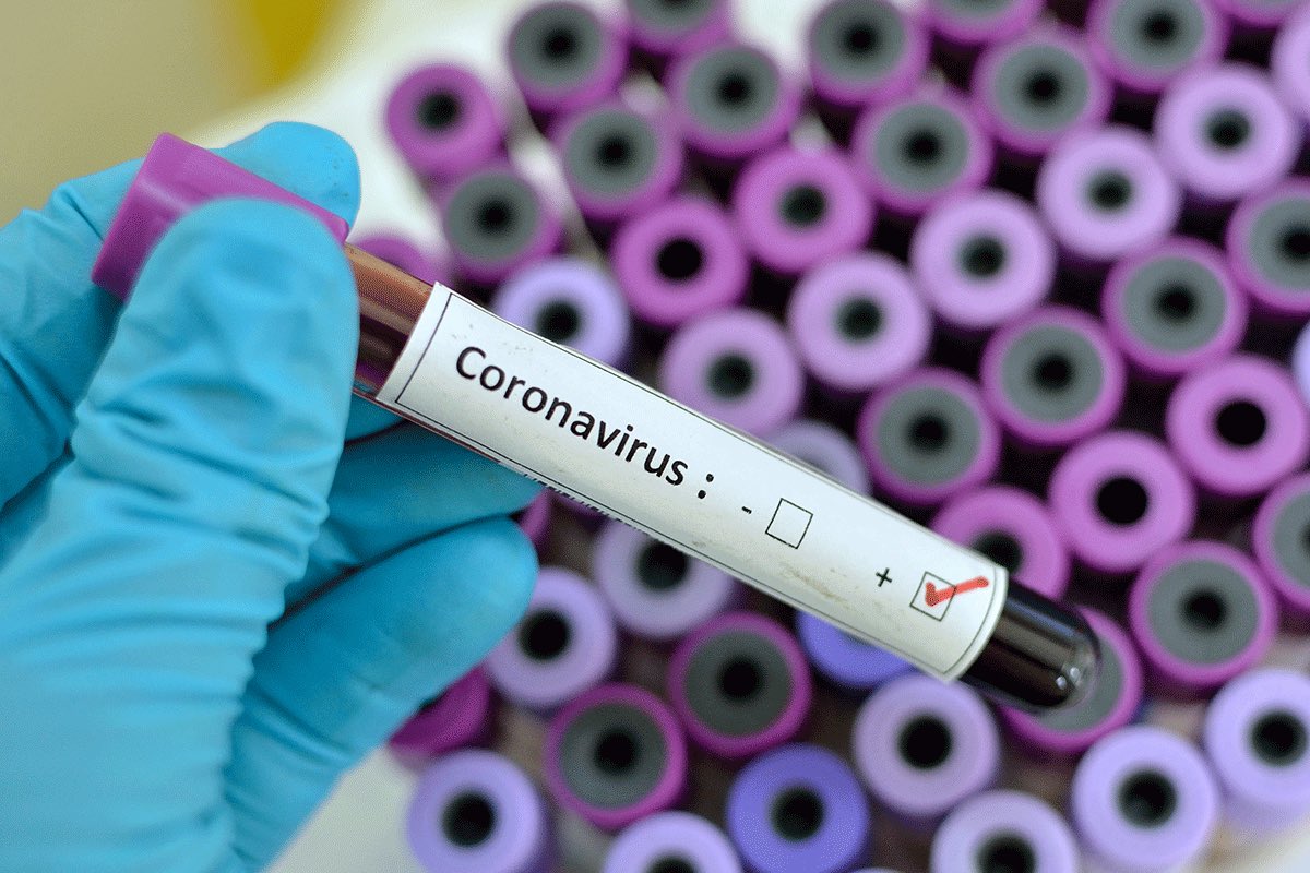 Все жители Москвы смогут бесплатно сделать тест на коронавирус с 16 июля