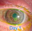 Врач использует макрорежим iPhone 13 Pro Max для проверки глаз пациентов