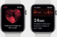 Apple Watch сообщили владельцу о проблемах с щитовидной железой за несколько месяцев до официального диагноза