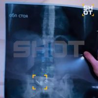 Жительница Уфы перепутала AirPods с таблетками и случайно проглотила. Врачи доставать отказались